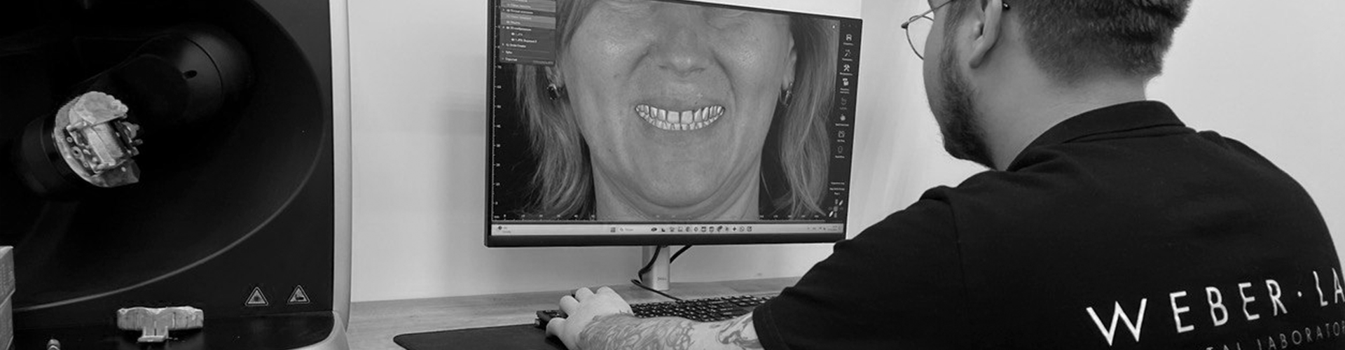 Digital WaxUp from photos (Smile Design)